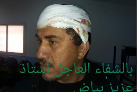 مدير ثانوية بالمحمدية يتعرَّض لاعتداء شنيع من طرف تلميذ