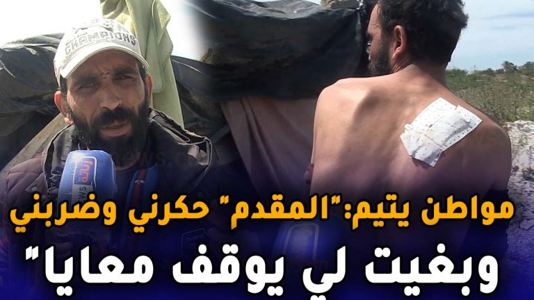مواطن يتيم معندوش لاكاراط ناسيونال “المقدم حكرني وضربني وبغيت لي يوقف معايا “